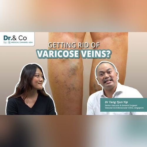 Getting Rid Of Varicose Veins Cover Photo