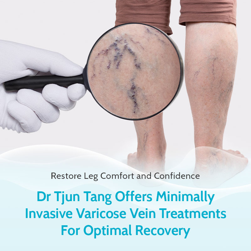 Restore Leg Comfort and Confidence